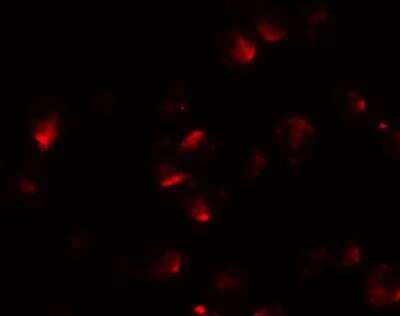 Immunocytochemistry/Immunofluorescence: Apc2 Antibody [NBP1-77376] - HeLa cells.