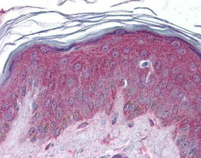 Immunohistochemistry: Apc2 Antibody [NBP2-87013] - Skin