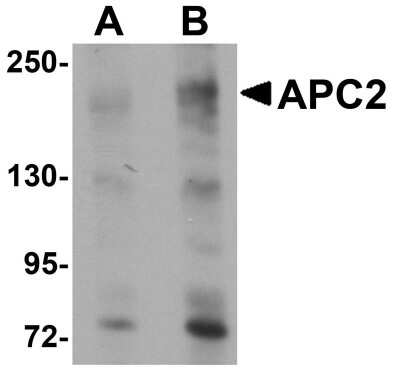 Western Blot: Apc2 Antibody [NBP1-77376] - HeLa cell lysate with APC2 antibody at (A) 1 and (B) 2 ug/mL.