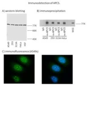 Western Blot: Apc5 Antibody (APC5-4) [NBP2-50106]