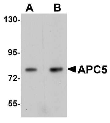 Western Blot: Apc5 Antibody [NBP1-77154] - Human kidney tissue lysate with APC5 antibody at (A) 1 and (B) 2 ug/mL.