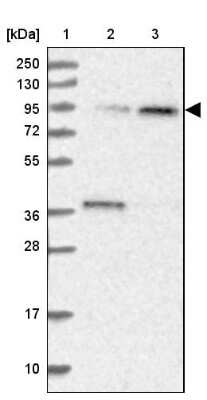 Western Blot: Apc5 Antibody [NBP1-90136] - Lane 1: Marker  [kDa] 250, 130, 95, 72, 55, 36, 28, 17, 10.  Lane 2: Human cell line RT-4.  Lane 3: Human cell line U-251MG sp