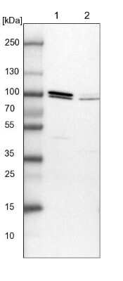 Western Blot: Apc5 Antibody [NBP1-90136] - Lane 1: NIH-3T3 cell lysate (Mouse embryonic fibroblast cells). Lane 2: NBT-II cell lysate (Rat Wistar bladder tumor cells).