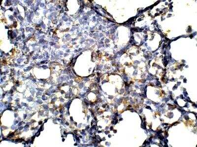 Immunohistochemistry-Paraffin Apelin Antibody