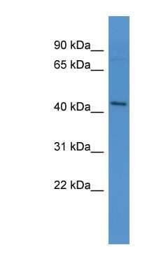 Western Blot: APJ/Apelin receptor Antibody [NBP1-68946] - MCF-7 whole cell lysates, concentration 0.2-1 ug/ml.