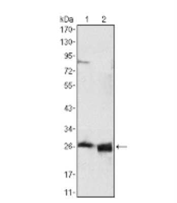 Western Blot: Apolipoprotein A-I/ApoA1 Antibody (5F4F5) [NBP2-59764] - Analysis using APOA1 mouse mAb against HepG2 cell lysate (1) and human serum (2).