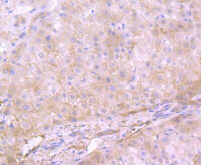 Immunohistochemistry-Paraffin: Apolipoprotein A-II/ApoA2 Antibody (JB70-35) [NBP2-75410] - Analysis of paraffin-embedded human liver tissue using anti-Apolipoprotein A II antibody. Counter stained with hematoxylin.