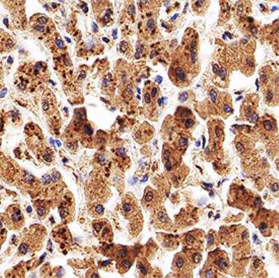 Immunohistochemistry-Paraffin: Apolipoprotein A5 Antibody (1G5G9) [NB110-55454] - IHC analysis of a formalin fixed paraffin-embedded (FFPE) human liver using 5 ug/ml conc. of Apolipoprotein A5 antibody on a Bond Rx autostainer (Leica Biosystems). The assay involved 20 minutes of heat induced antigen retrieval (HIER) using 10mM sodium citrate buffer (pH 6.0) and endogenous peroxidase quenching with peroxide block. The sections were incubated with primary antibody for 30 minutes and Bond Polymer Refine Detection (Leica Biosystems) with DAB was used for signal development followed by counterstaining with hematoxylin. Whole slide scanning and capturing of representative images was performed using Aperio AT2 (Leica Biosystems). Cytoplasmic staining of Apolipoprotein A5 in hepatocytes was observed. Staining was performed by Histowiz.