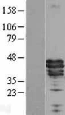 Western Blot: Apolipoprotein A5 Overexpression Lysate (Adult Normal) [NBL1-07611] Left-Empty vector transfected control cell lysate (HEK293 cell lysate); Right -Over-expression Lysate for Apolipoprotein A5.