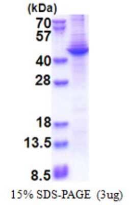 SDS-Page: Recombinant Human Apolipoprotein A5 Protein [NBP2-22689]