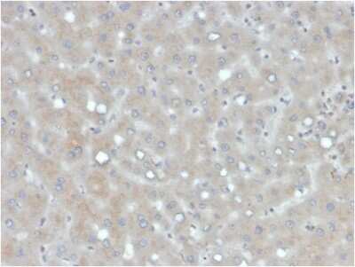 Immunohistochemistry-Paraffin: Apolipoprotein B/ApoB Antibody (APOB/4333) - Azide and BSA Free [NBP3-08230] - Formalin-fixed, paraffin-embedded human liver stained with Apolipoprotein B/ApoB Mouse Monoclonal Antibody (APOB/4333).