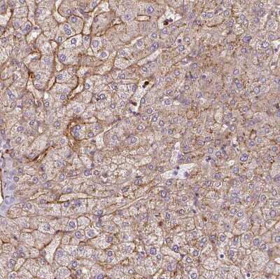 Immunohistochemistry-Paraffin: Apolipoprotein C1 Antibody [NBP2-49010] - Staining of human liver shows moderate granular cytoplasmic positivity in hepatocytes.