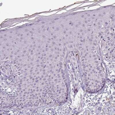 Immunohistochemistry-Paraffin: Apolipoprotein C1 Antibody [NBP2-49010] - Staining of human skin shows very weak granular cytoplasmic positivity in squamous epithelial cells.