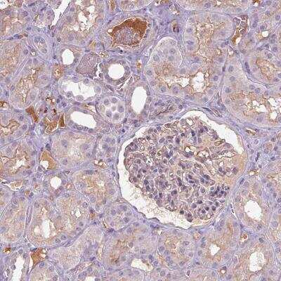 Immunohistochemistry: Apolipoprotein C4 Antibody [NBP2-46869] - Staining of human kidney shows moderate membranous positivity in cells in tubules along with distinctly stained extracellular material/ Plasma.