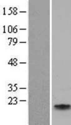 Western Blot Apolipoprotein C4 Overexpression Lysate