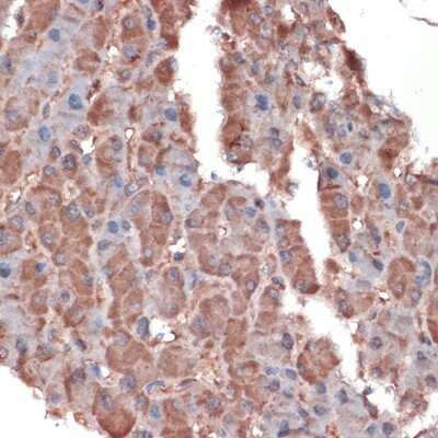 Immunohistochemistry-Paraffin: Apolipoprotein CIII Antibody (3T7Y5) [NBP3-16093] - Immunohistochemistry of paraffin-embedded human liver using Apolipoprotein CIII Rabbit mAb (NBP3-16093) at dilution of 1:100 (40x lens).Perform microwave antigen retrieval with 10 mM Tris/EDTA buffer pH 9.0 before commencing with IHC staining protocol.