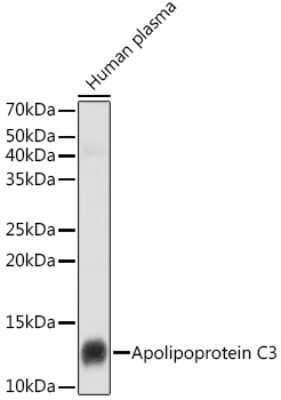 Western Blot: Apolipoprotein CIII Antibody (3T7Y5) [NBP3-16093] - Western blot analysis of extracts of Human plasma cells, using Apolipoprotein CIII antibody (NBP3-16093) at 1:1000 dilution. Secondary antibody: HRP Goat Anti-Rabbit IgG (H+L) at 1:10000 dilution. Lysates/proteins: 25ug per lane. Blocking buffer: 3% nonfat dry milk in TBST. Detection: ECL Basic Kit. Exposure time: 5s.