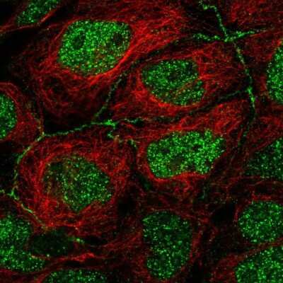 Immunocytochemistry/Immunofluorescence: Apolipoprotein CIII Antibody [NBP2-68831] - Staining of human cell line CACO-2 shows localization to nucleoplasm & cell junctions.