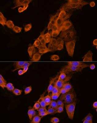 Immunocytochemistry/Immunofluorescence: Apolipoprotein CIII Antibody [NBP2-92734] - Analysis of HepG2 cells using Apolipoprotein C3 Rabbit pAb at dilution of 1:250 (40x lens). Blue: DAPI for nuclear staining.