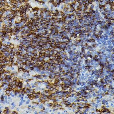 Immunohistochemistry-Paraffin Apolipoprotein CIII Antibody - Azide and BSA Free