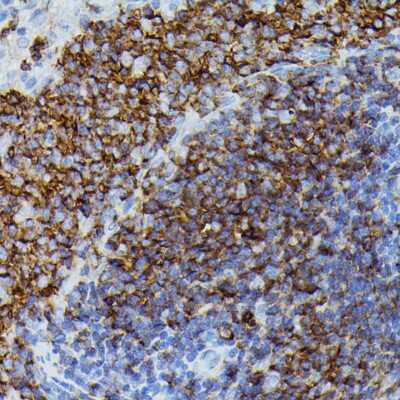 Immunohistochemistry-Paraffin Apolipoprotein CIII Antibody - Azide and BSA Free