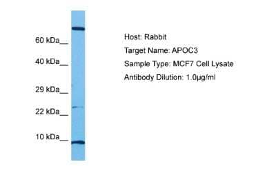 Western Blot: Apolipoprotein CIII Antibody [NBP2-87015] - Host: Rabbit. Target Name: APOC3. Sample Tissue: Human MCF7 Whole Cell lysates. Antibody Dilution: 1ug/ml