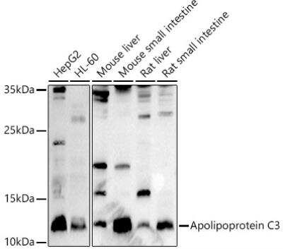 Western Blot: Apolipoprotein CIII Antibody [NBP2-92734] - Analysis of extracts of various cell lines, using Apolipoprotein C3 antibody at 1:1000 dilution. Secondary antibody: HRP Goat Anti-Rabbit IgG (H+L) at 1:10000 dilution.Lysates/proteins: 25ug per lane. Blocking buffer: 3% nonfat dry milk in TBST.Detection: ECL Basic Kit. Exposure time: 90s.