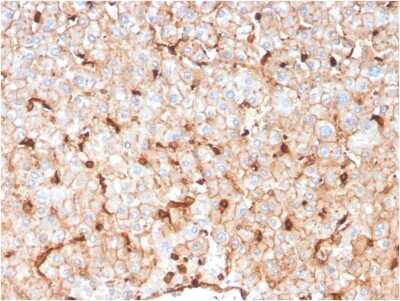 Immunohistochemistry-Paraffin: Apolipoprotein D Antibody (APOD/3414) [NBP3-08437] - Formalin-fixed, paraffin-embedded human liver stained with Apolipoprotein D Mouse Monoclonal Antibody (APOD/3414).