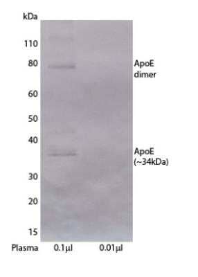 Western Blot: Apolipoprotein E/ApoE Antibody (E981) [NBP3-18297] - Detection of human Apolipoprotein E/ApoE with NBP3-18297 in Western blot. Human plasma (0.1 ul and 0.01 ul) in SDS sample buffer were denatured at 70C for 10 minutes and run on SDS-page / Western blot. ApoE was detected using 1 ug/ml E981 (biotinylated) followed by SA-ALP and BCIP/NBT-plus substrate.