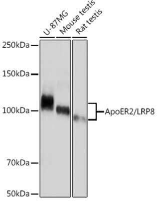 Western Blot: Apolipoprotein E R2/ApoE R2 Antibody (0V1R8) [NBP3-16872] - Western blot analysis of extracts of various cell lines, using Apolipoprotein E R2/ApoE R2 Rabbit mAb (NBP3-16872) at 1:1000 dilution. Secondary antibody: HRP Goat Anti-Rabbit IgG (H+L) at 1:10000 dilution. Lysates/proteins: 25ug per lane. Blocking buffer: 3% nonfat dry milk in TBST. Detection: ECL Basic Kit. Exposure time: 30s.