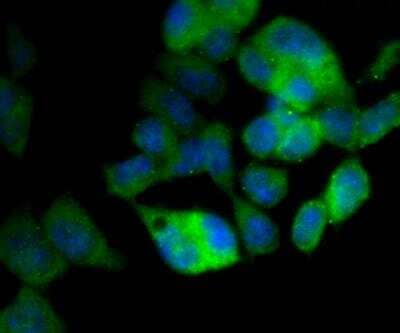 Immunocytochemistry/Immunofluorescence: Apolipoprotein E R2/ApoE R2 Antibody [NBP2-76911] - ICC staining ApoER2 in F9 cells (green). The nuclear counter stain is DAPI (blue). Cells were fixed in paraformaldehyde, permeabilised with 0.25% Triton X100/PBS.