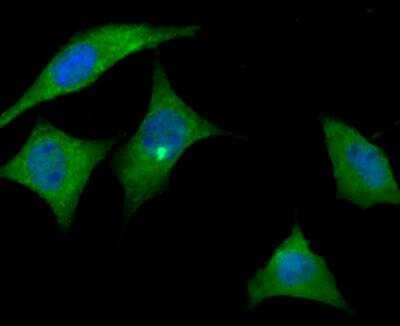 Immunocytochemistry/Immunofluorescence: Apolipoprotein E R2/ApoE R2 Antibody [NBP2-76911] - ICC staining ApoER2 in SH-SY-5Y cells (green). The nuclear counter stain is DAPI (blue). Cells were fixed in paraformaldehyde, permeabilised with 0.25% Triton X100/PBS.