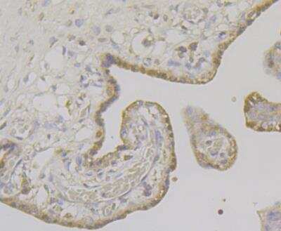 Immunohistochemistry: Apolipoprotein E R2/ApoE R2 Antibody [NBP2-76911] - Immunohistochemical analysis of paraffin-embedded human placenta tissue using anti-ApoER2 antibody. Counter stained with hematoxylin.