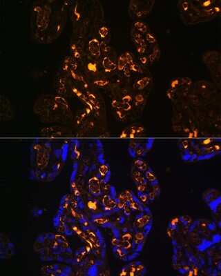 Immunohistochemistry: Apolipoprotein E R2/ApoE R2 Antibody [NBP2-92026] - Immunofluorescence analysis of Human placenta using ApoER2/Apolipoprotein E R2/ApoE R2 antibody (NBP2-92026) at dilution of 1:100. Blue: DAPI for nuclear staining.