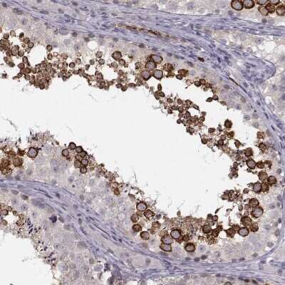 Immunohistochemistry-Paraffin: Apolipoprotein E R2/ApoE R2 Antibody [NBP2-62680] - Staining of human testis shows high expression.