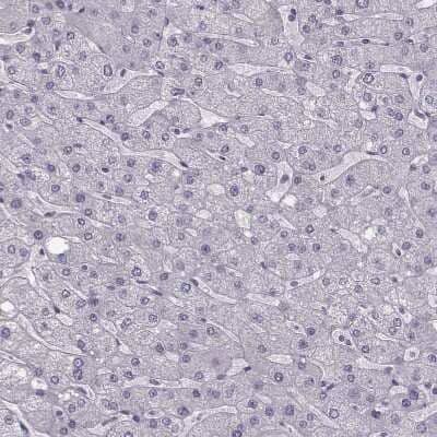 Immunohistochemistry-Paraffin: Apolipoprotein E R2/ApoE R2 Antibody [NBP2-62680] - Staining of human liver shows no positivity in hepatocytes as expected.