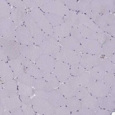 Immunohistochemistry-Paraffin: Apolipoprotein E R2/ApoE R2 Antibody [NBP2-62680] - Staining of human skeletal muscle shows no positivity in myocytes as expected.