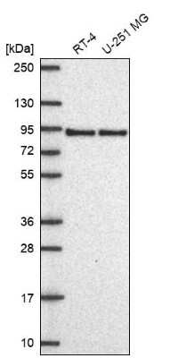 Western Blot: Apolipoprotein E R2/ApoE R2 Antibody [NBP2-62680] - Analysis in human cell line RT-4 and human cell line U-251 MG.