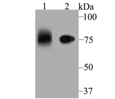 Western Blot Apolipoprotein E R2/ApoE R2 Antibody
