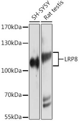 Western Blot: Apolipoprotein E R2/ApoE R2 Antibody [NBP2-92026] - Analysis of extracts of various cell lines, using Apolipoprotein E R2/ApoE R2 at 1:1000 dilution.Secondary antibody: HRP Goat Anti-Rabbit IgG (H+L) at 1:10000 dilution.Lysates/proteins: 25ug per lane.Blocking buffer: 3% nonfat dry milk in TBST.Detection: ECL Basic Kit .Exposure time: 30s.