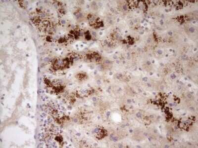 Immunohistochemistry: Apolipoprotein H/ApoH Antibody (OTI4A11) - Azide and BSA Free [NBP2-70186] - Analysis of Human liver tissue. (Heat-induced epitope retrieval by 1 mM EDTA in 10mM Tris, pH8.5, 120C for 3min)