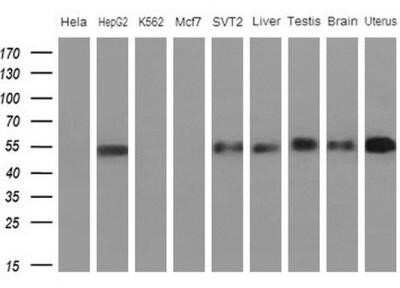 Western Blot: Apolipoprotein H/ApoH Antibody (OTI4A11) - Azide and BSA Free [NBP2-70186] - Analysis of extracts (10ug) from 5 different cell lines and 4 human tissues(1: Hela; 2: HepG2; 3: K562; 4: Mcf7; 5: SVT2; 6: Liver; 7: Testis; 8: Brain; 9: Uterus)