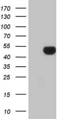 Western Blot: Apolipoprotein H/ApoH Antibody (OTI4A11) - Azide and BSA Free [NBP2-70186] - Analysis of HEK293T cells were transfected with the pCMV6-ENTRY control (Left lane) or pCMV6-ENTRY Apolipoprotein H.