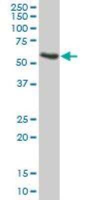 Western Blot: Apolipoprotein H/ApoH Antibody [H00000350-B01P] - Analysis of APOH expression in human kidney.