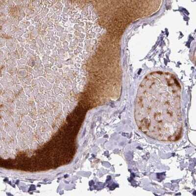 Immunohistochemistry-Paraffin: Apolipoprotein L1 Antibody (CL0171) [NBP2-14785] - Staining of human colon shows plasma positivity.