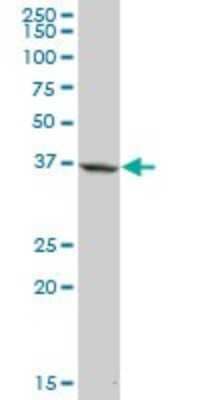 Western Blot: Apolipoprotein L1 Antibody [H00008542-B01P] - Analysis of APOL1 expression in human pancreas.