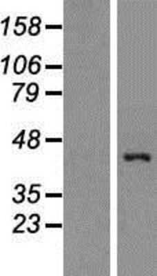 Western Blot: Apolipoprotein L1 Overexpression Lysate (Adult Normal) [NBP2-11079] Left-Empty vector transfected control cell lysate (HEK293 cell lysate); Right -Over-expression Lysate for Apolipoprotein L1.