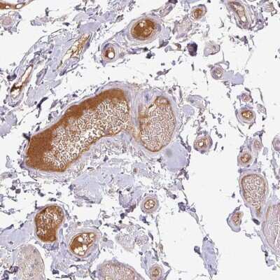 Immunohistochemistry-Paraffin Apolipoprotein M/ApoM Antibody - BSA Free
