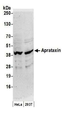 <b>Biological Strategies Validation. </b>Western Blot: Aprataxin Antibody [NB100-534] - Detection of Human Aprataxin by Western Blot. Samples: Whole cell lysate (50 ug) from HeLa and 293T cells prepared using NETN lysis buffer. Antibody: Affinity purified rabbit anti-Aprataxin antibody NB100-534 used for WB at 0.04 ug/ml. Detection: Chemiluminescence with an exposure time of 3 minutes.