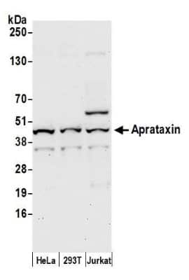 Western Blot: Aprataxin Antibody [NB100-534] - Detection of human Aprataxin by western blot. Samples: Whole cell lysate (50 µg) from HeLa, HEK293T, and Jurkat cells prepared using NETN lysis buffer. Antibody: Affinity purified rabbit anti-Aprataxin antibody NB100-534 used for WB at 0.1 µg/ml. Detection: Chemiluminescence with an exposure time of 30 seconds.